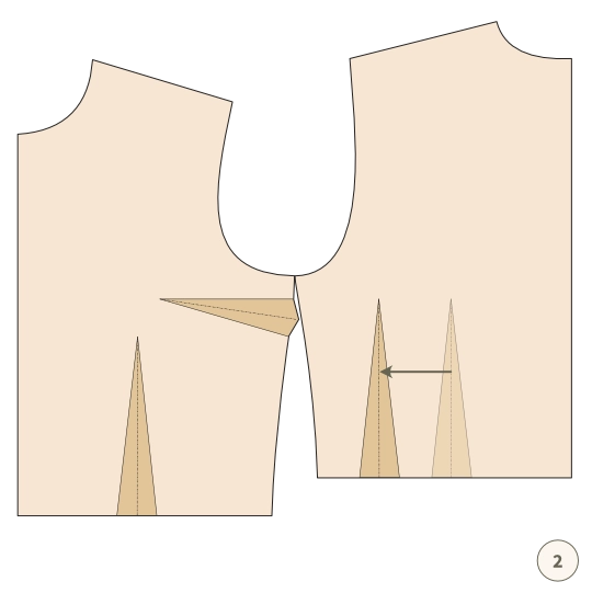 Zaszewka – jak ją usunąć albo przenieść - 5