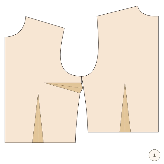 Zaszewka – jak ją usunąć albo przenieść - 1