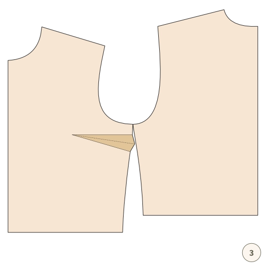 Zaszewka – jak ją usunąć albo przenieść - 3