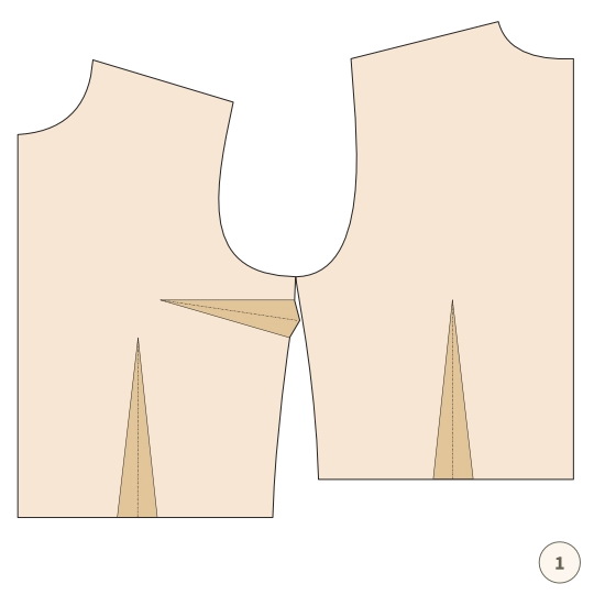 Zaszewka – jak ją usunąć albo przenieść - 6